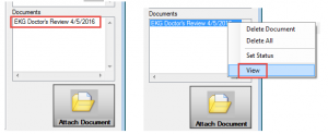Attach Document and View